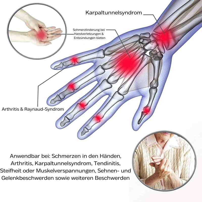 Fingerlose Kompressionshandschuhe für bewegliche & schmerzfreie Hände - VitalGrip